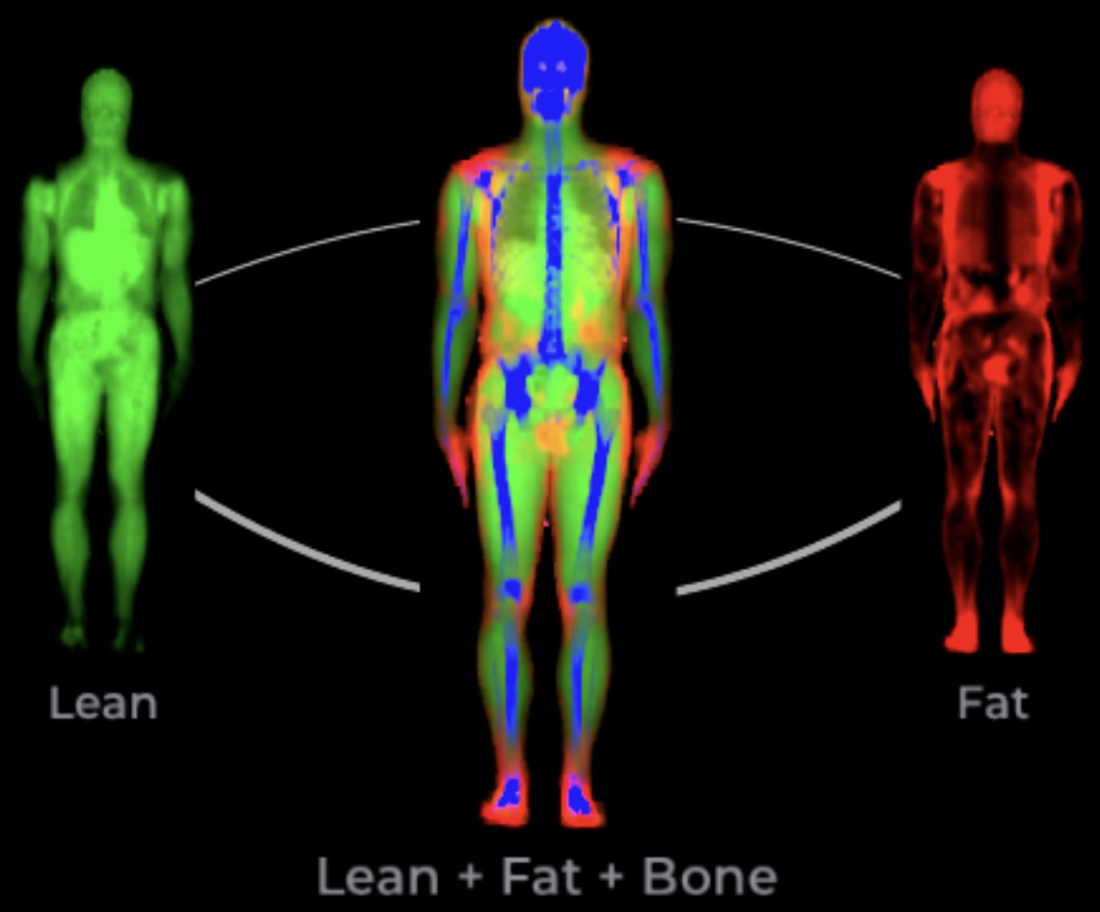One DEXA scan separated into lean tissue, fat, and bone